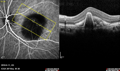 眼科OCT检查技术简介-天津中医一附属医院-站群