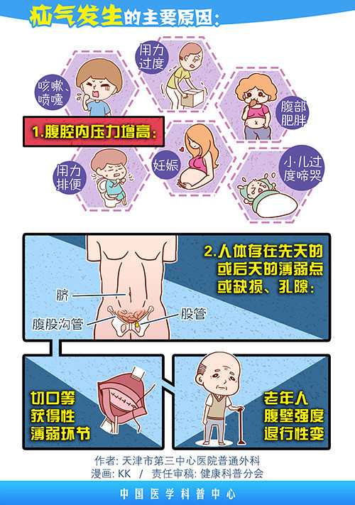 画说:疝气的外科治疗——无张力疝修补术