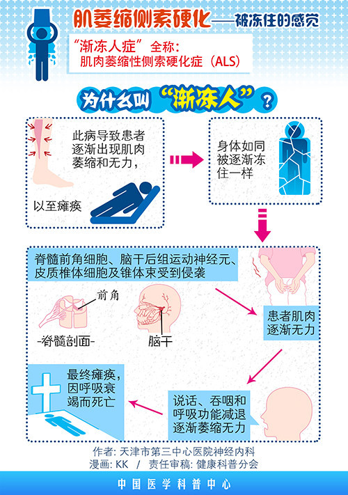 什么是肌萎缩侧索硬化als