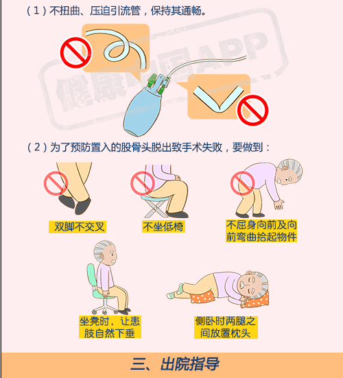 股骨颈骨折病人健康知识宣教