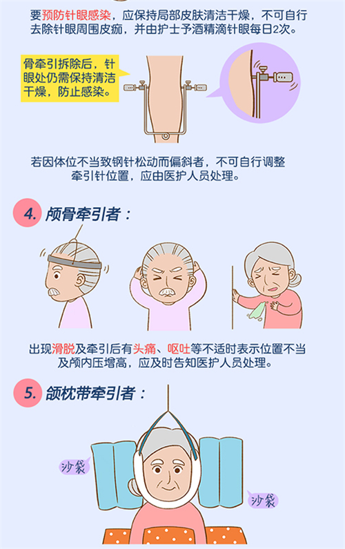 牵引病人健康知识宣教