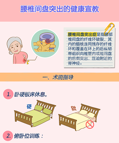 腰椎间盘突出症病人健康知识宣教