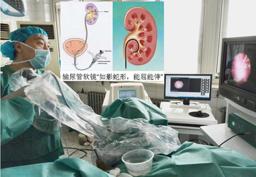 外三科成功开展输尿管软镜碎石取石新技术