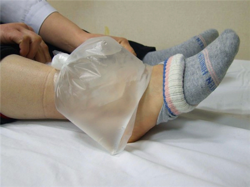 运动损伤后的正确冰敷方法